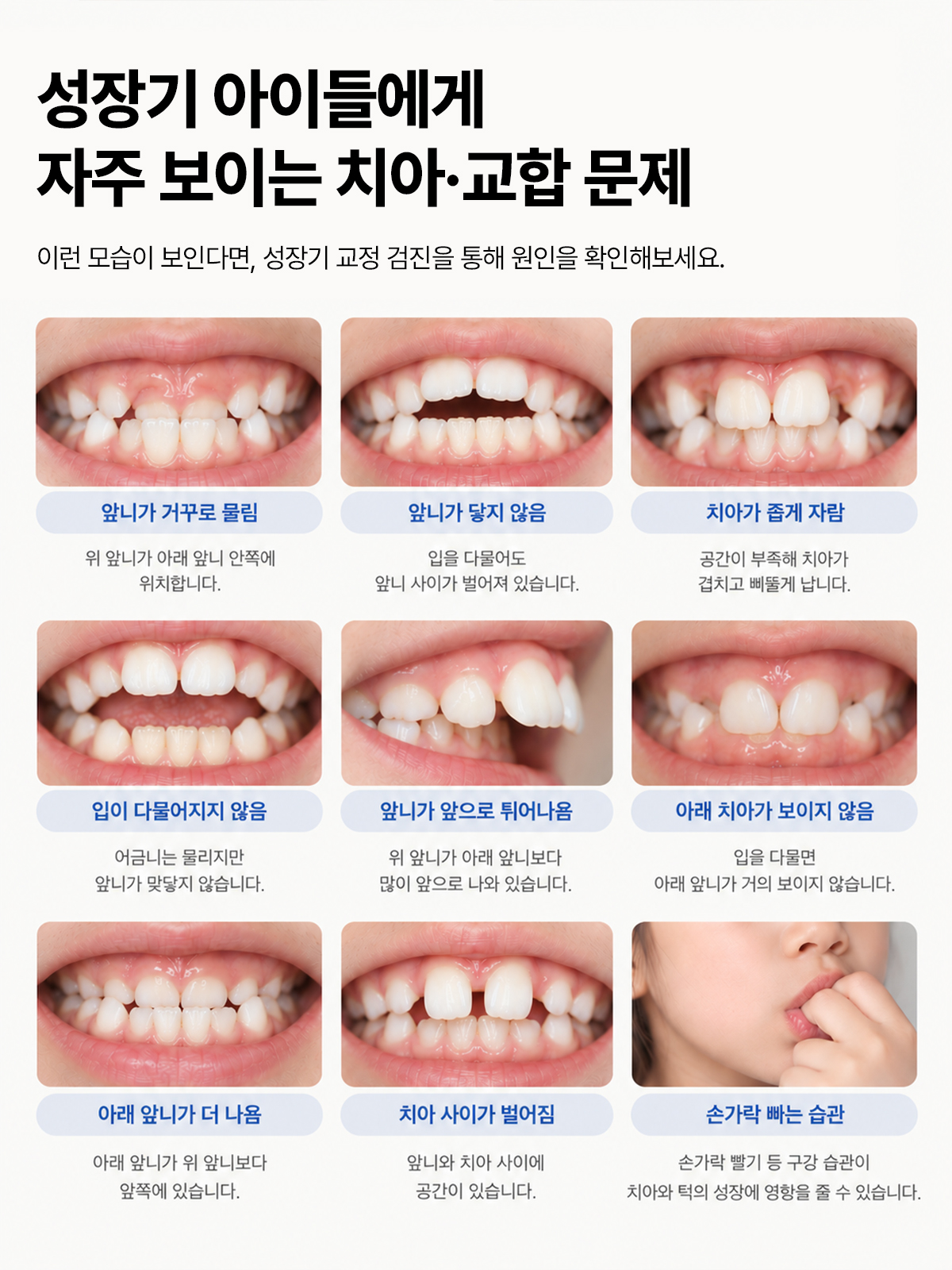 성장기 아이에게 자주 보이는 치아·교합 문제 9가지(반대교합·앞니가 닿지 않음·덧니·돌출·치아 사이 벌어짐·손가락 빠는 습관 등)를 사진으로 모은 안내 그림