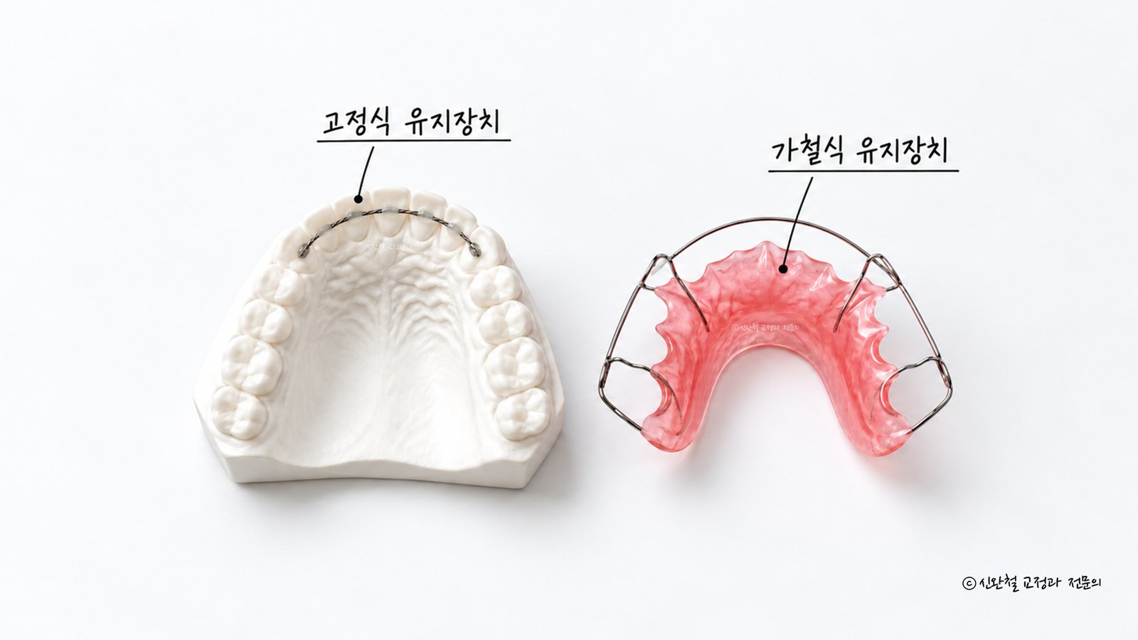 앞니 안쪽에 철사를 붙인 고정식 유지장치 모형과 분홍색 플라스틱에 철사가 달린 가철식 유지장치를 나란히 놓고 이름을 표시한 사진